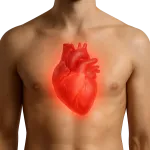 Cardiopatie