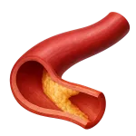 Colesterolo